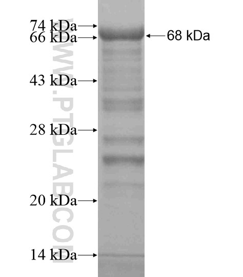 KIAA0586 fusion protein Ag19669 SDS-PAGE KIAA0586 fusion protein Ag19669 SDS-PAGE