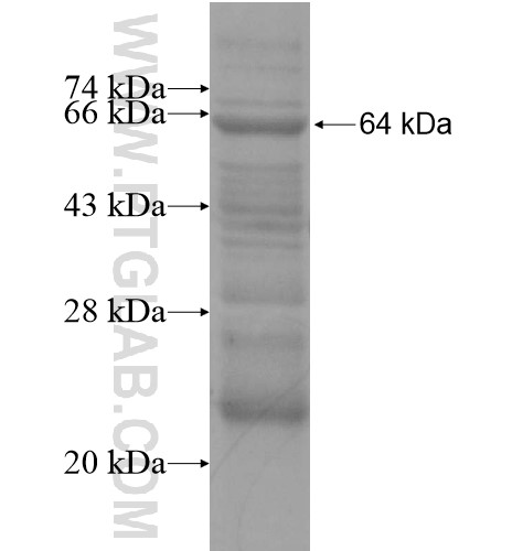 KIAA0644 fusion protein Ag15116 SDS-PAGE KIAA0644 fusion protein Ag15116 SDS-PAGE