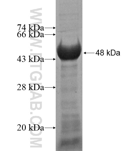 KIAA0644 fusion protein Ag15469 SDS-PAGE KIAA0644 fusion protein Ag15469 SDS-PAGE