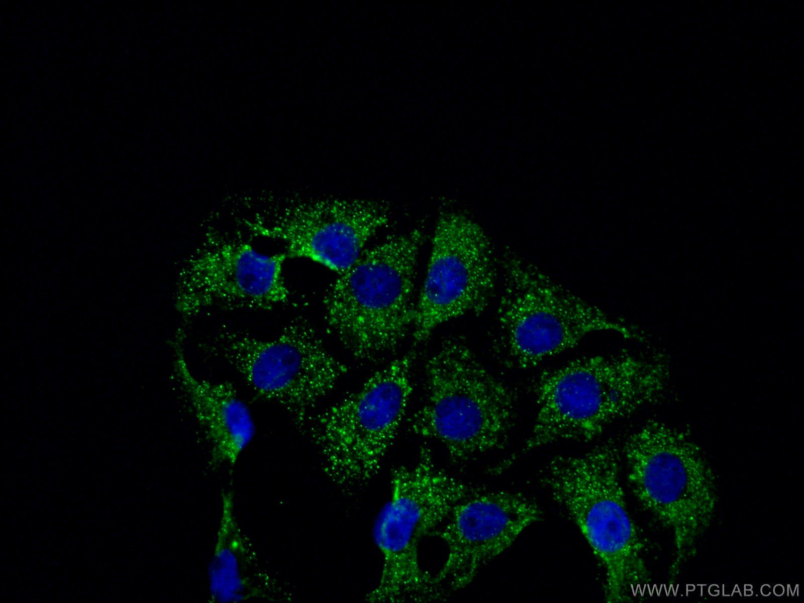 IF Staining of SH-SY5Y using 18258-1-AP