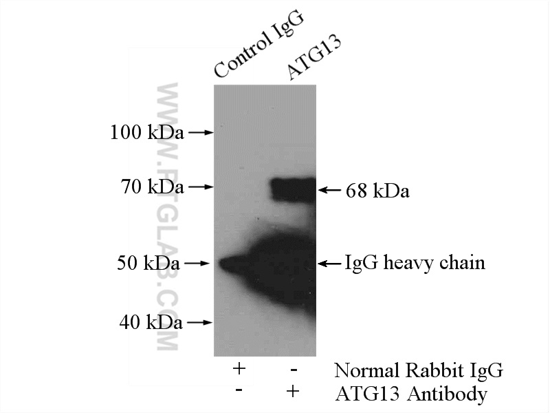 IP experiment of SH-SY5Y using 18258-1-AP