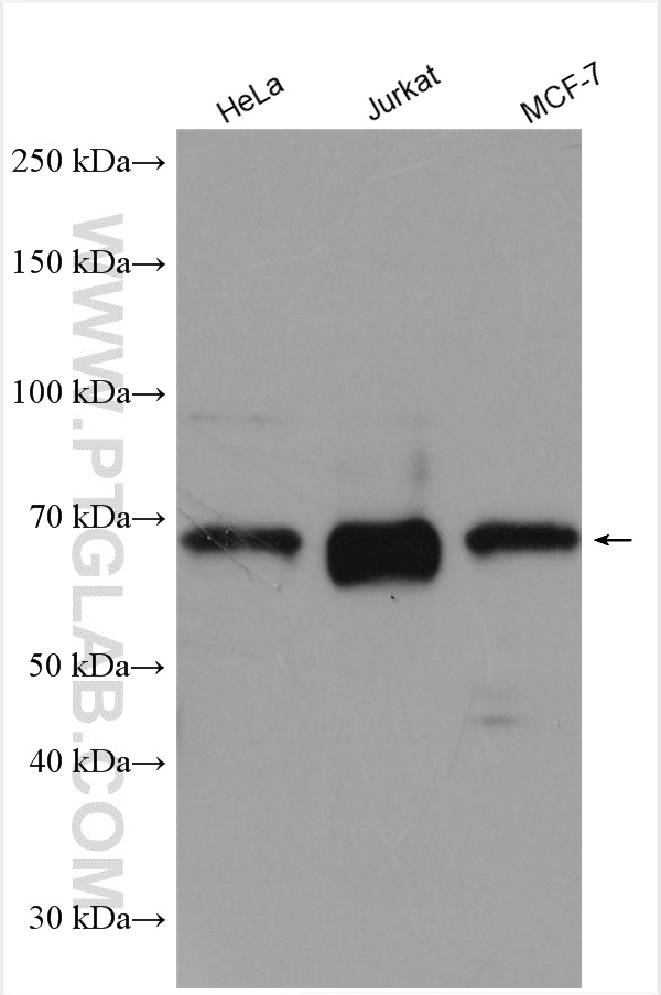 WB analysis using 18258-1-AP