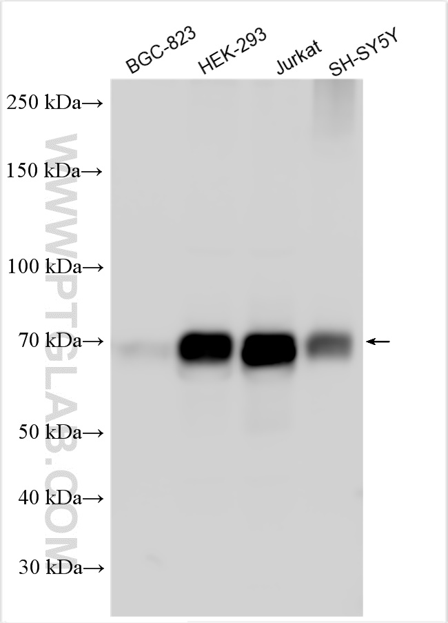 WB analysis using 18258-1-AP