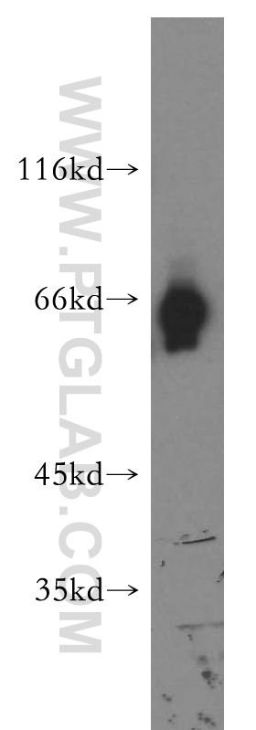 ATG13 Polyclonal antibody