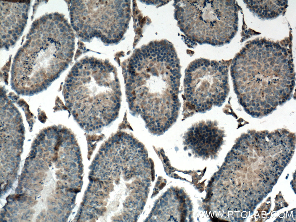 IHC staining of mouse testis using 66708-1-Ig (same clone as 66708-1-PBS)