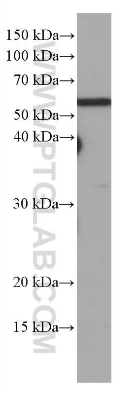 WB analysis of BGC-823 using 66708-1-Ig