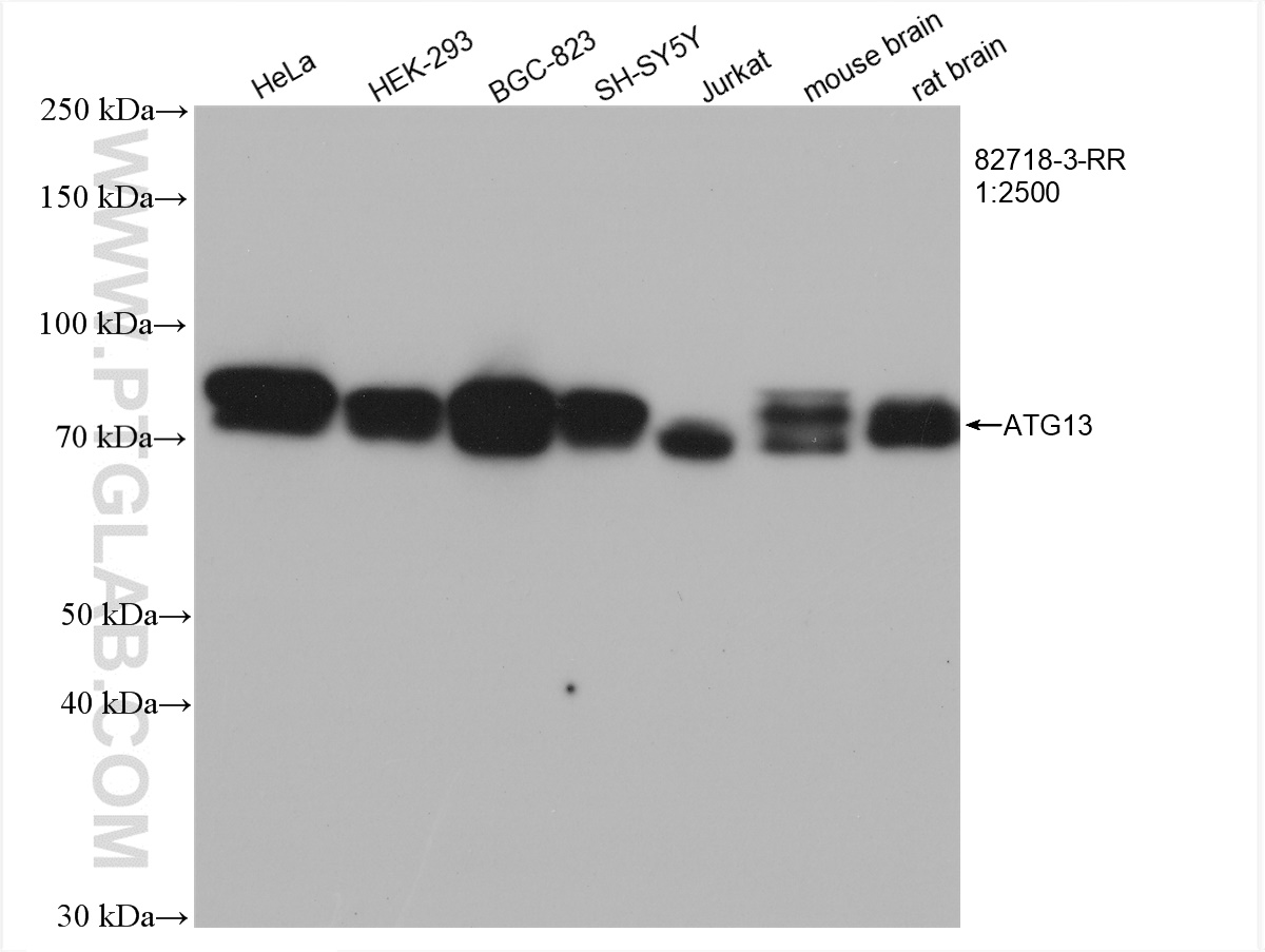 WB analysis using 82718-3-RR (same clone as 82718-3-PBS)