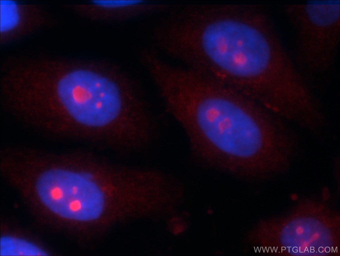 IF Staining of HepG2 using 24921-1-AP