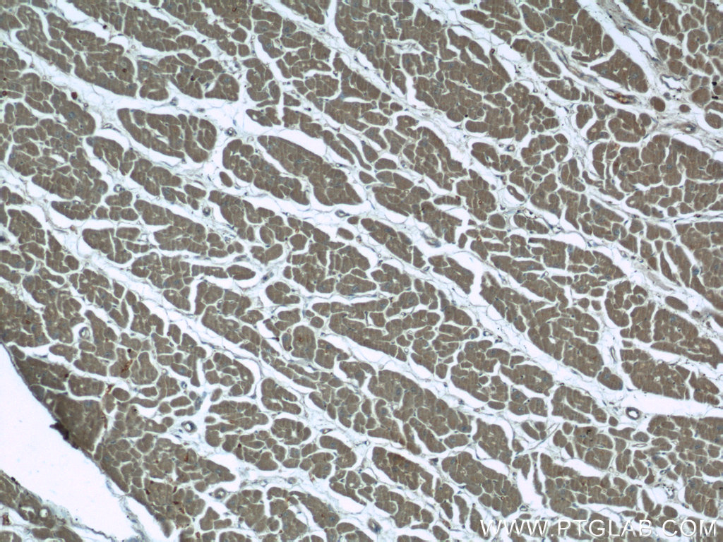 IHC staining of human heart using 24921-1-AP