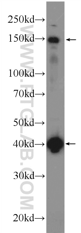 WB analysis of mouse brain using 24921-1-AP