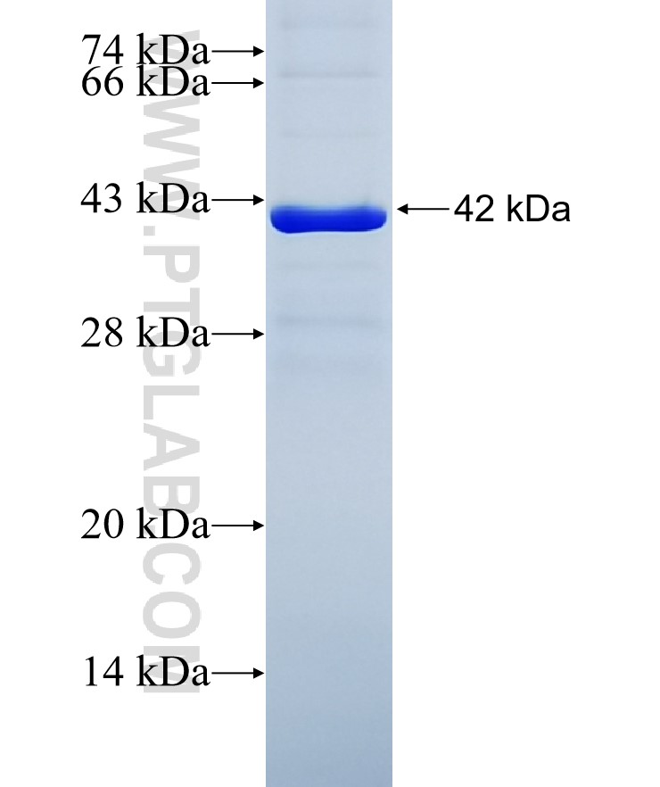 KIAA0776 fusion protein Ag23404 SDS-PAGE