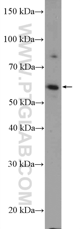 WB analysis of mouse testis using 21930-1-AP