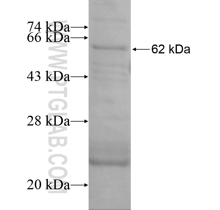 KIAA0895 fusion protein Ag15379 SDS-PAGE KIAA0895 fusion protein Ag15379 SDS-PAGE