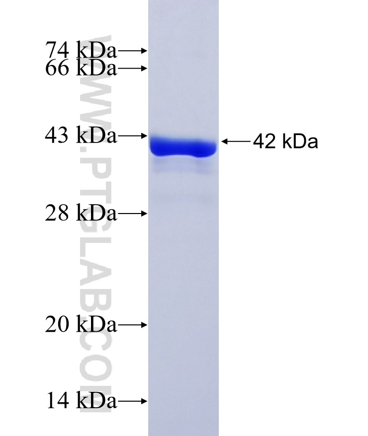 KIAA0895L fusion protein Ag37410 SDS-PAGE KIAA0895L fusion protein Ag37410 SDS-PAGE