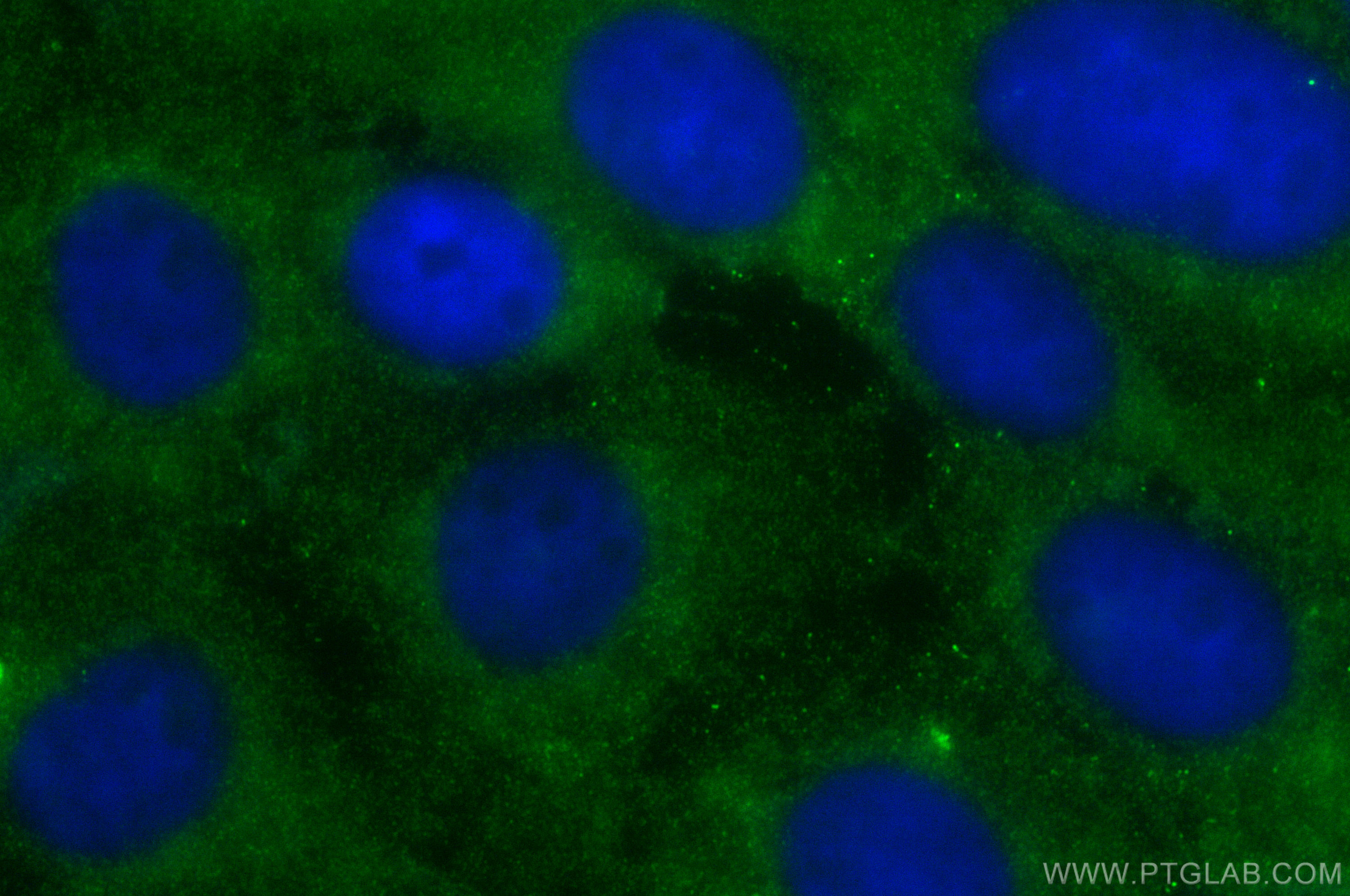 IF Staining of A431 using 23360-1-AP