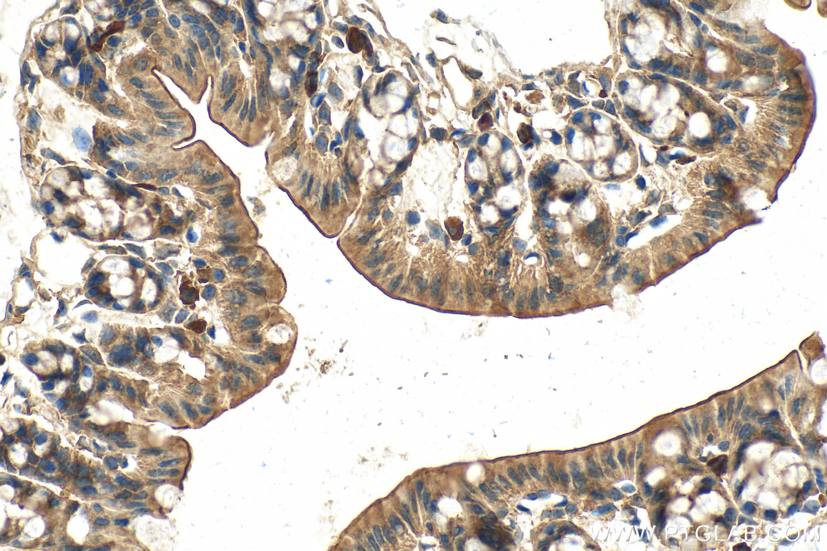 IHC staining of mouse colon using 23360-1-AP