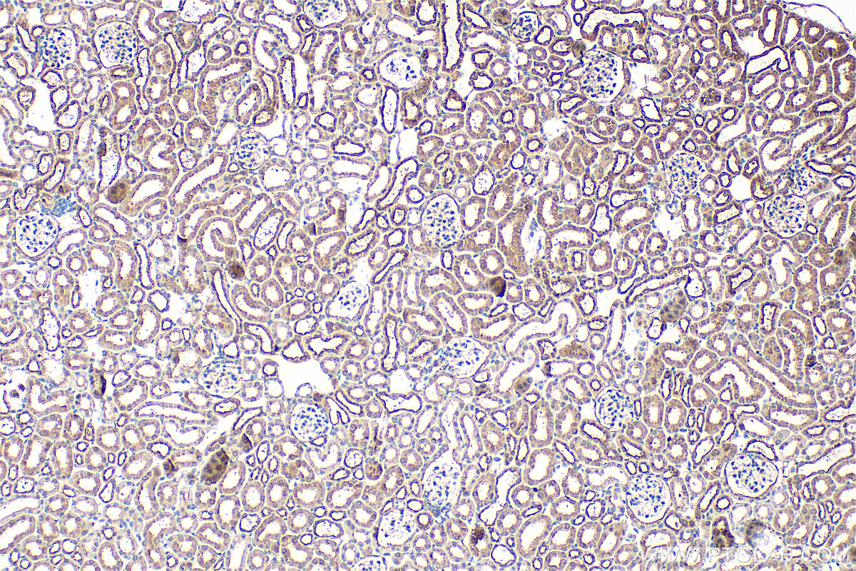 IHC staining of mouse kidney using 23360-1-AP