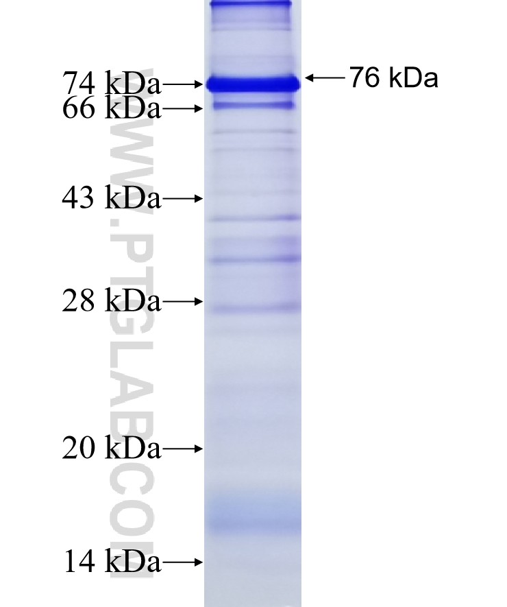 KIAA0922 fusion protein Ag19898 SDS-PAGE