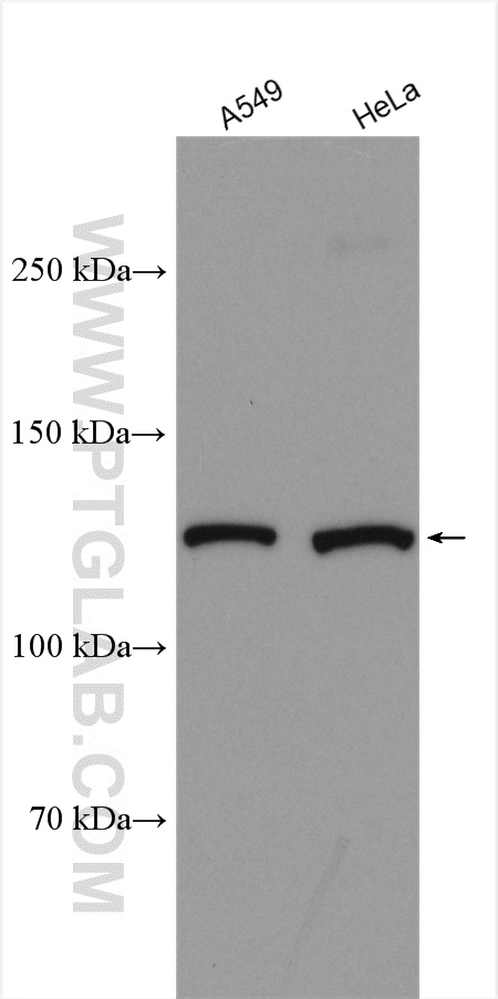 WB analysis using 51101-1-AP