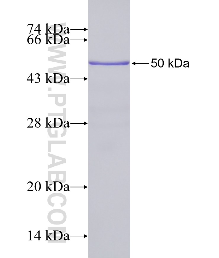 KIAA1109 fusion protein Ag23625 SDS-PAGE