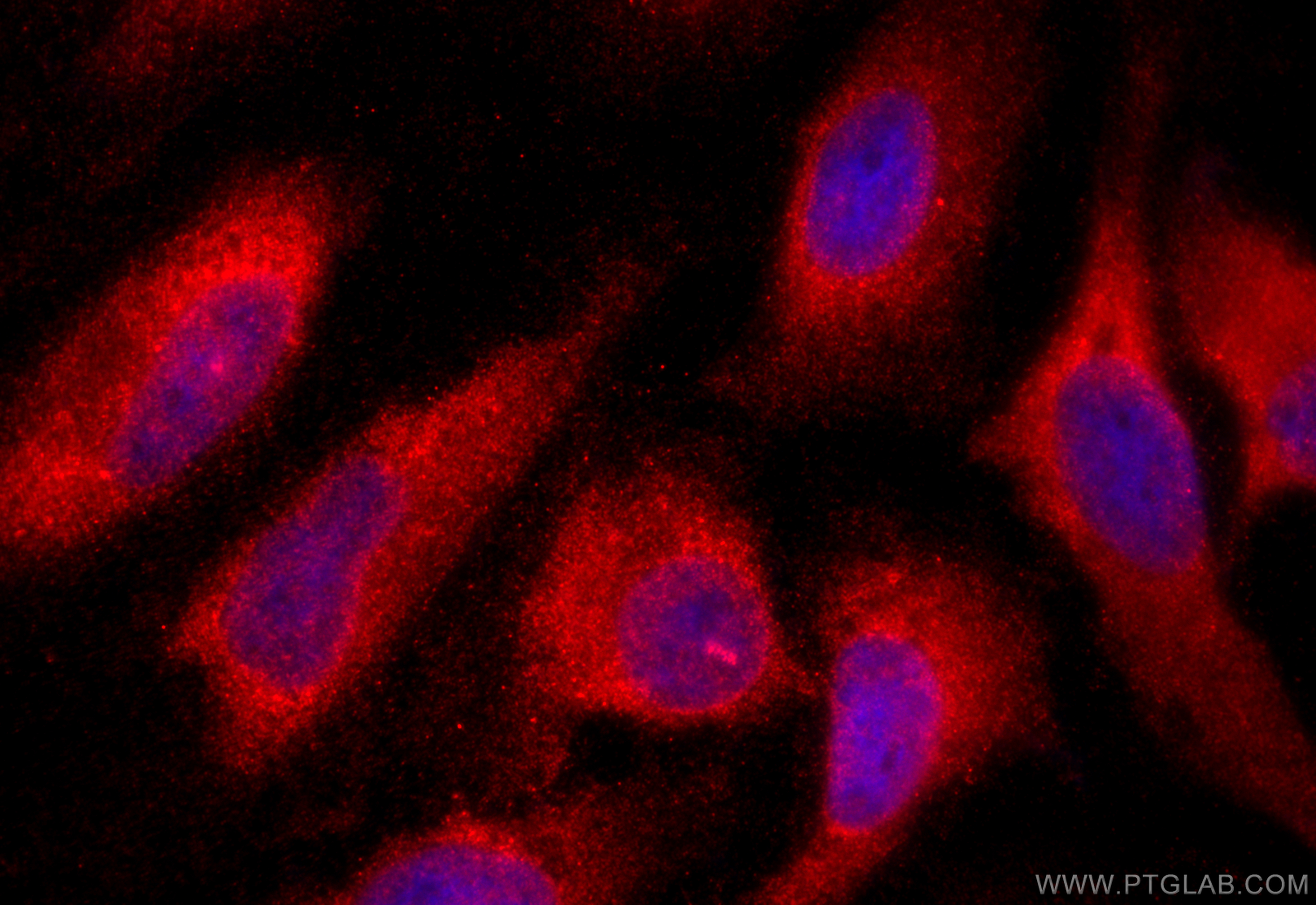 IF Staining of HeLa using 20637-1-AP