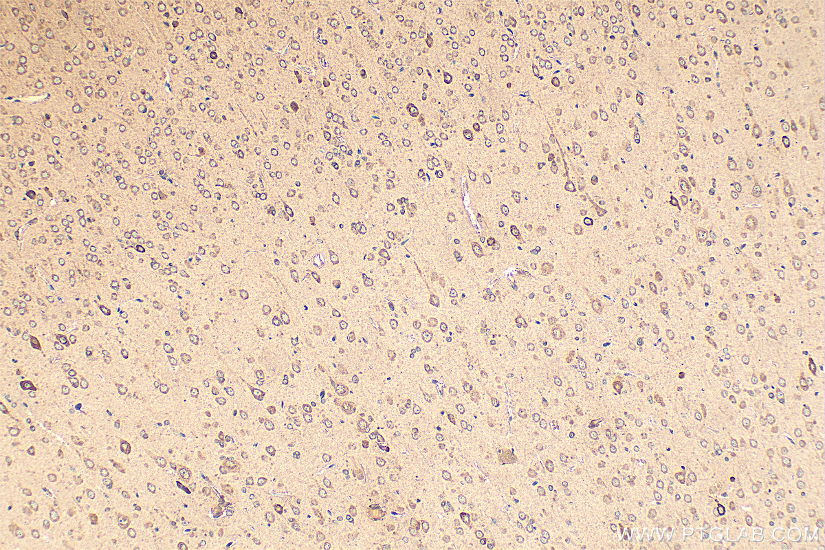 Immunohistochemical analysis of paraffin-embedded rat brain tissue slide using 21129-1-AP (<a class='green' href='/productredirect?CatalogNo=KIAA1199' target='_blank'>KIAA1199</a> / CEMIP antibody) at dilution of 1:200 (under 10x lens). Heat mediated antigen retrieval with Tris-EDTA buffer (pH 9.0). IHC staining of rat brain using 21129-1-AP