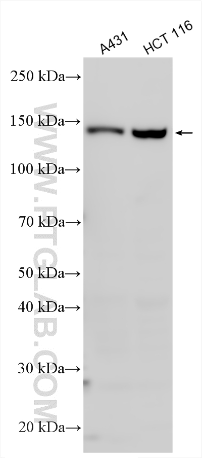 WB analysis using 21129-1-AP