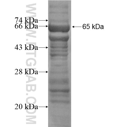 KIAA1199 fusion protein Ag15527 SDS-PAGE