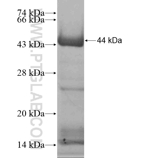 KIAA1267 fusion protein Ag18653 SDS-PAGE KIAA1267 fusion protein Ag18653 SDS-PAGE