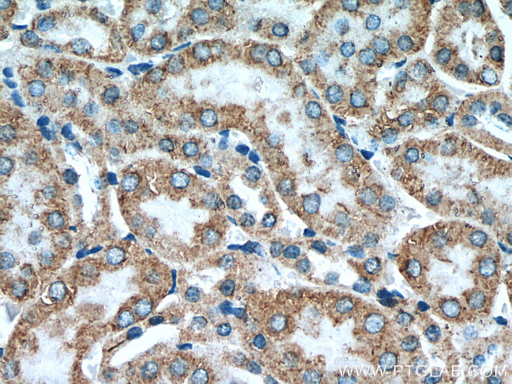 IHC staining of mouse kidney using 25653-1-AP