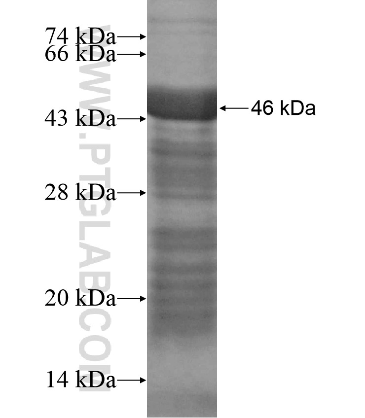 KIAA1370 fusion protein Ag17374 SDS-PAGE KIAA1370 fusion protein Ag17374 SDS-PAGE