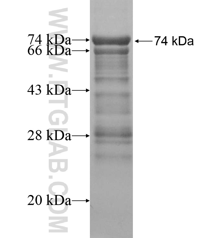 KIAA1383 fusion protein Ag16447 SDS-PAGE KIAA1383 fusion protein Ag16447 SDS-PAGE