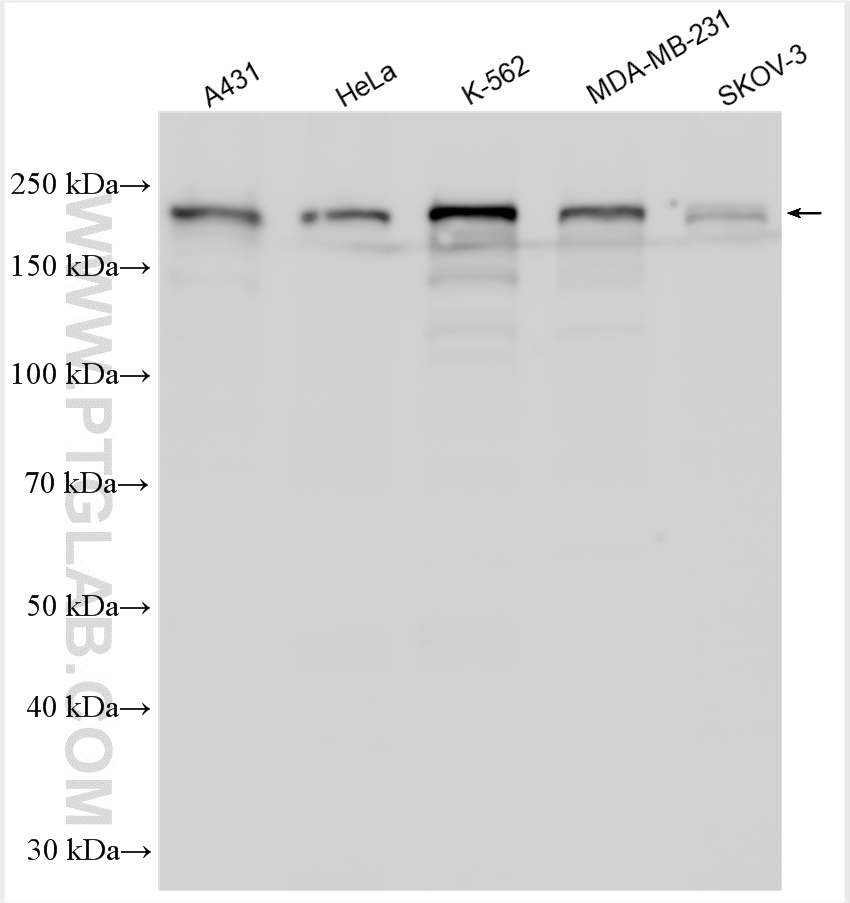 WB analysis using 30166-1-AP