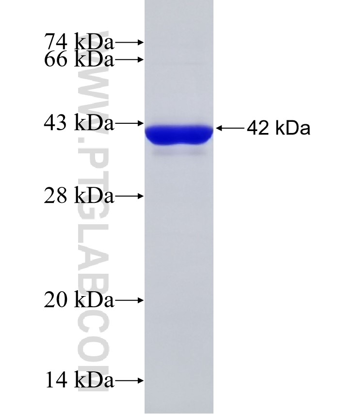 KIAA1429 fusion protein Ag32849 SDS-PAGE KIAA1429 fusion protein Ag32849 SDS-PAGE