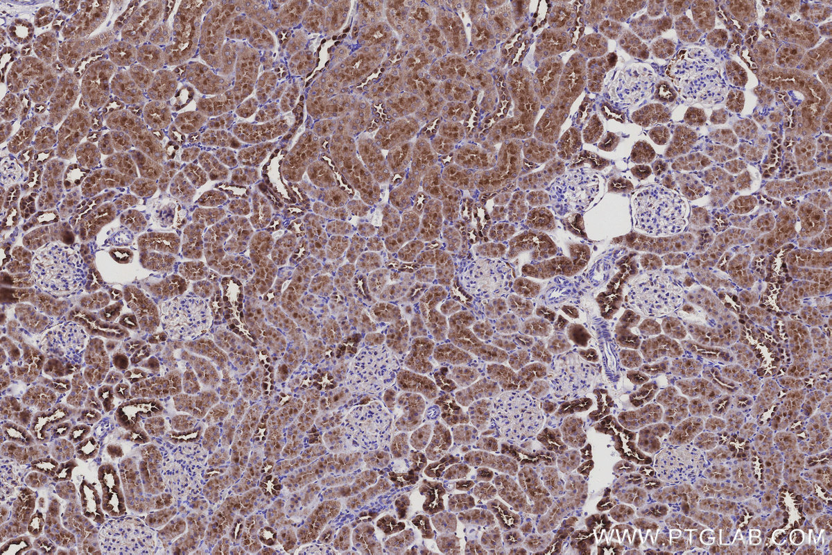 IHC staining of rat kidney using 18993-1-AP IHC staining of rat kidney using 18993-1-AP