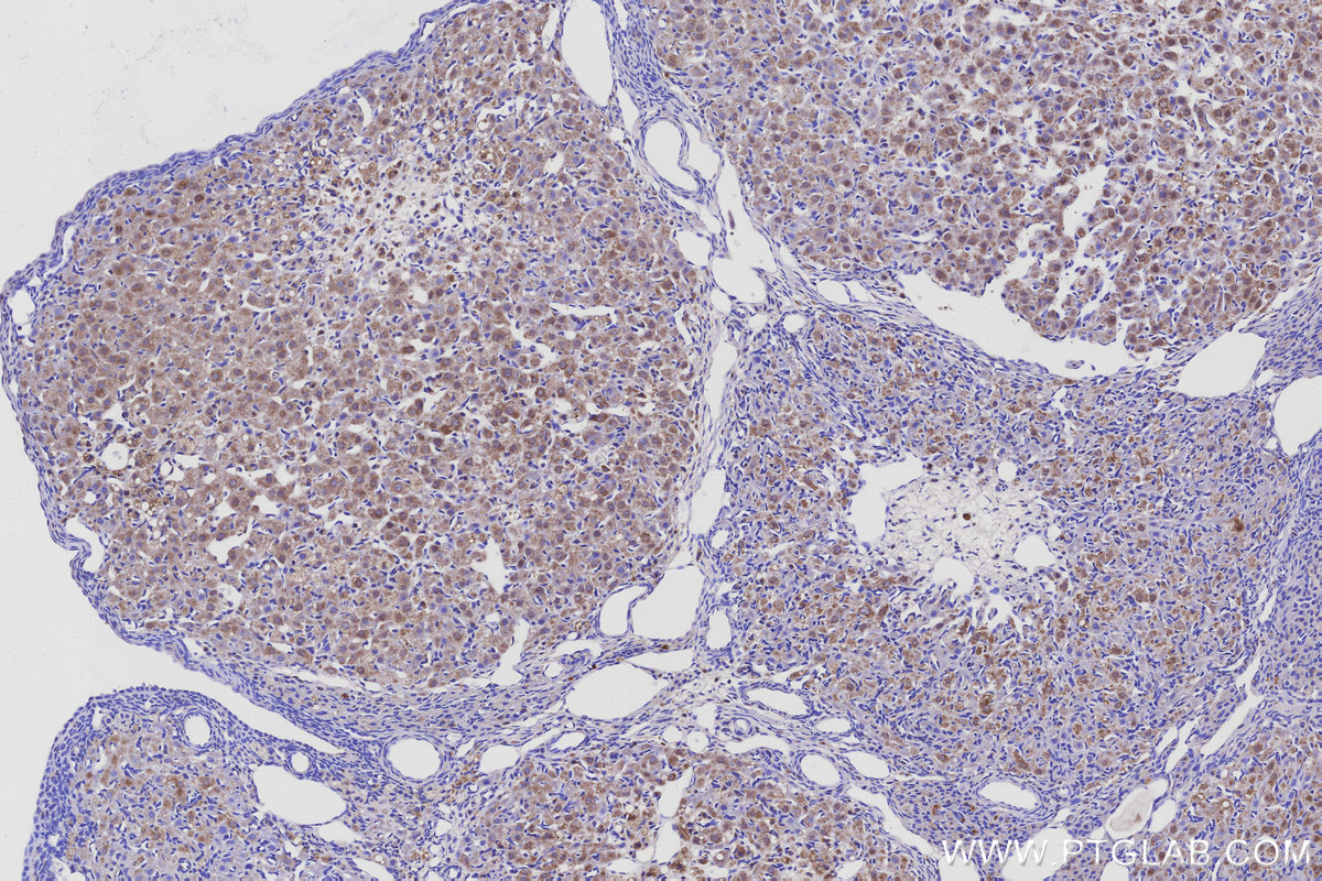 IHC staining of rat ovary using 18993-1-AP IHC staining of rat ovary using 18993-1-AP