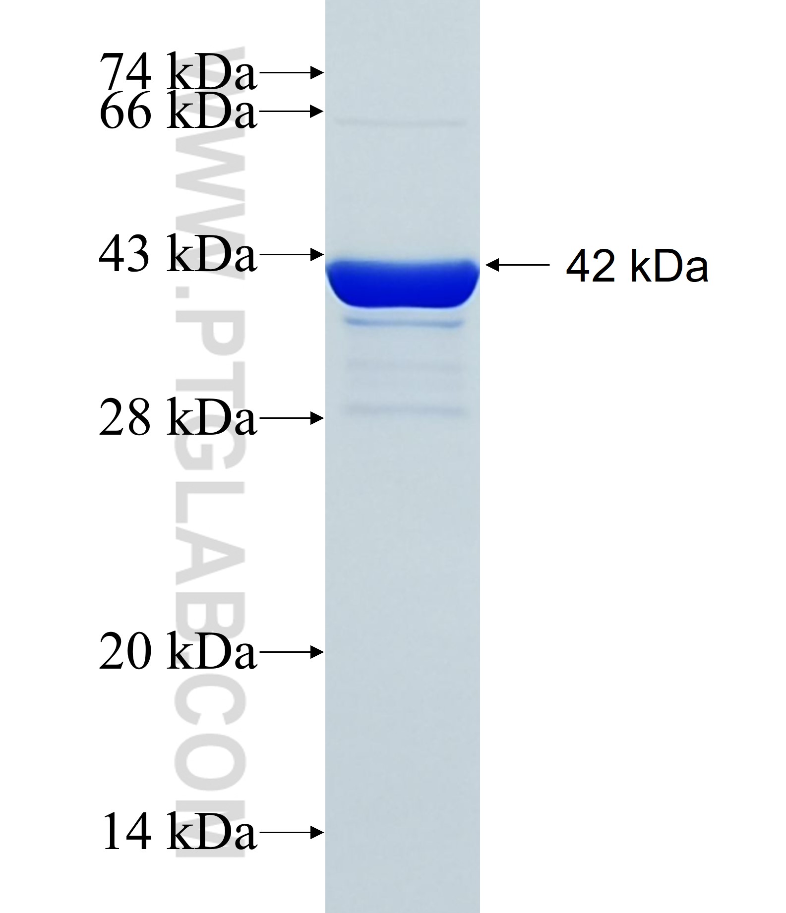 KIAA1522 fusion protein Ag35083 SDS-PAGE KIAA1522 fusion protein Ag35083 SDS-PAGE