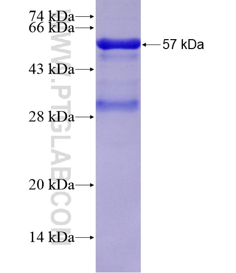 KIAA1524 fusion protein Ag19597 SDS-PAGE KIAA1524 fusion protein Ag19597 SDS-PAGE