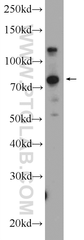 KIAA1530