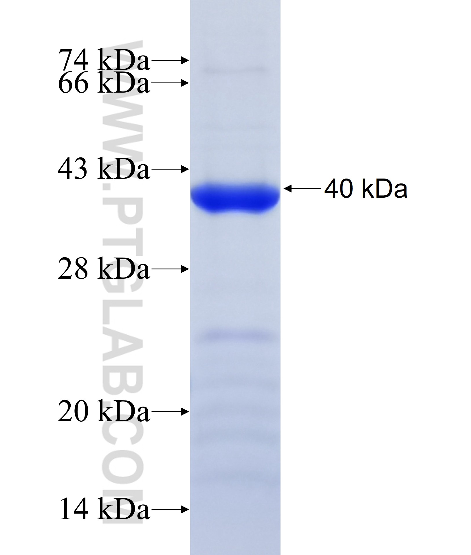 KIAA1539 fusion protein Ag36975 SDS-PAGE KIAA1539 fusion protein Ag36975 SDS-PAGE