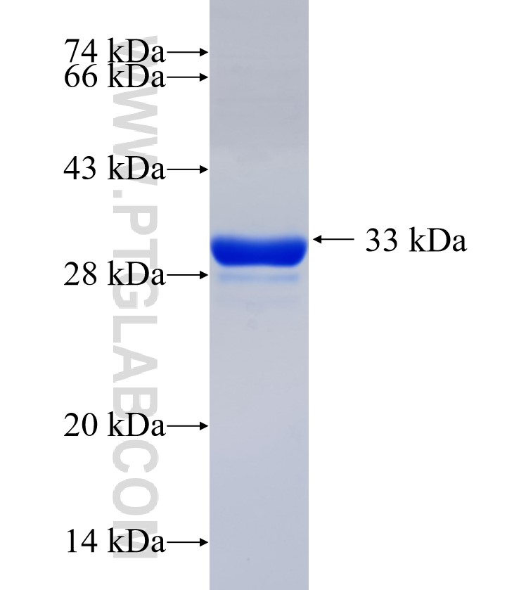 KIAA1549 fusion protein Ag37568 SDS-PAGE