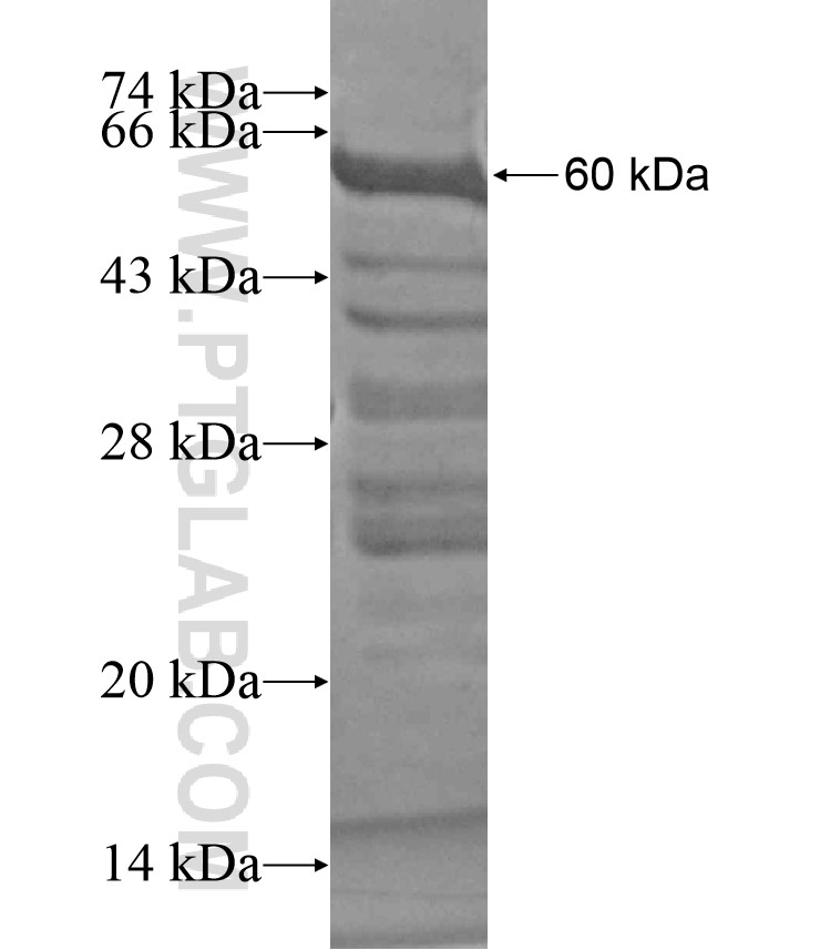 KIAA1598 fusion protein Ag18294 SDS-PAGE