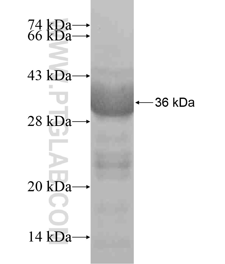 KIAA1598 fusion protein Ag18342 SDS-PAGE