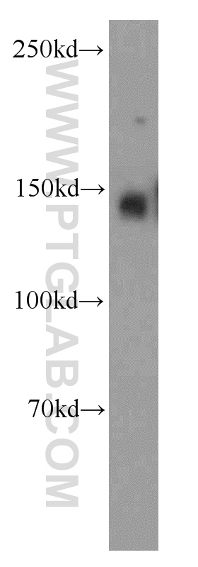 WB analysis of HeLa using 21392-1-AP