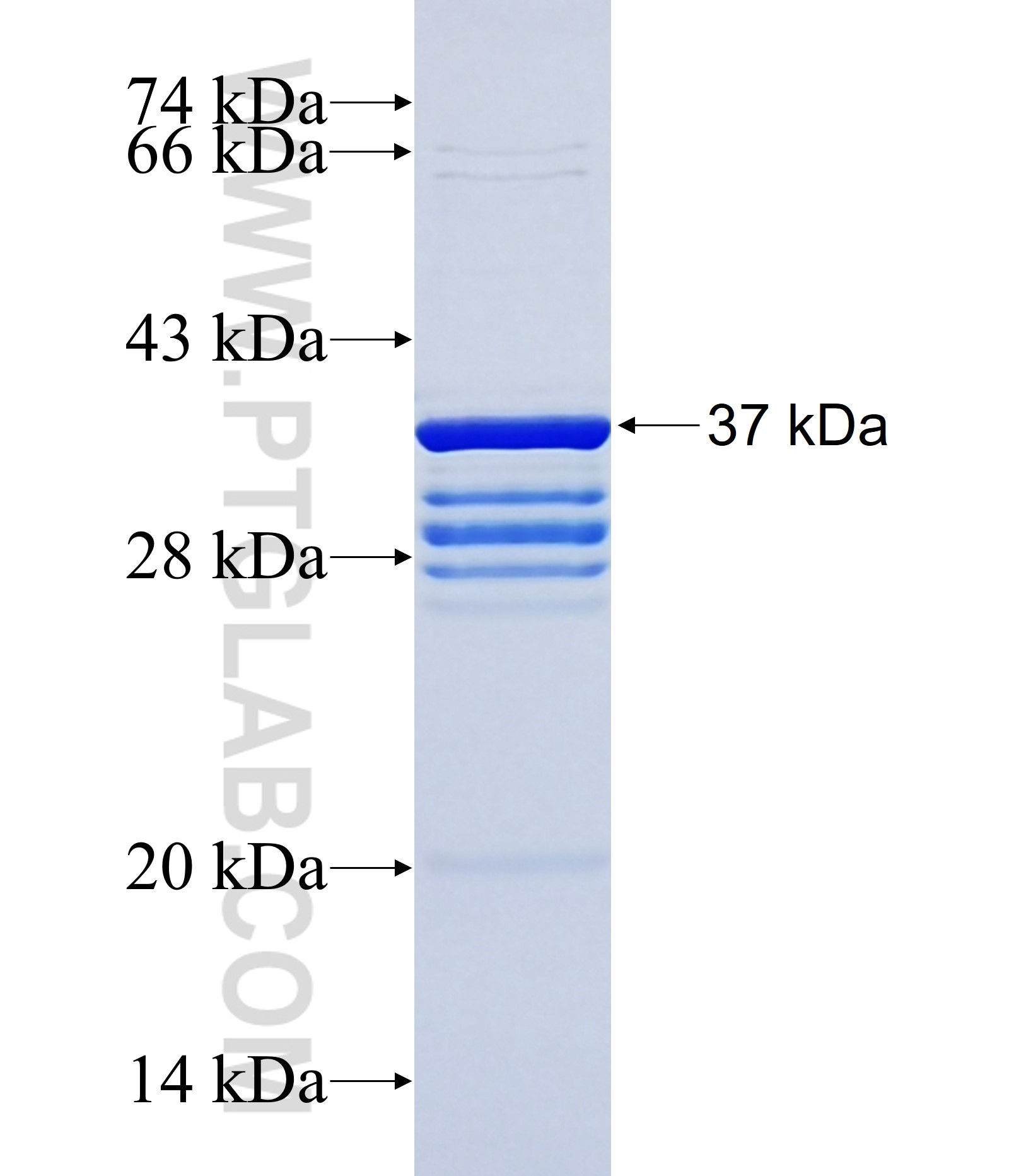 KIAA1688 fusion protein Ag37238 SDS-PAGE KIAA1688 fusion protein Ag37238 SDS-PAGE