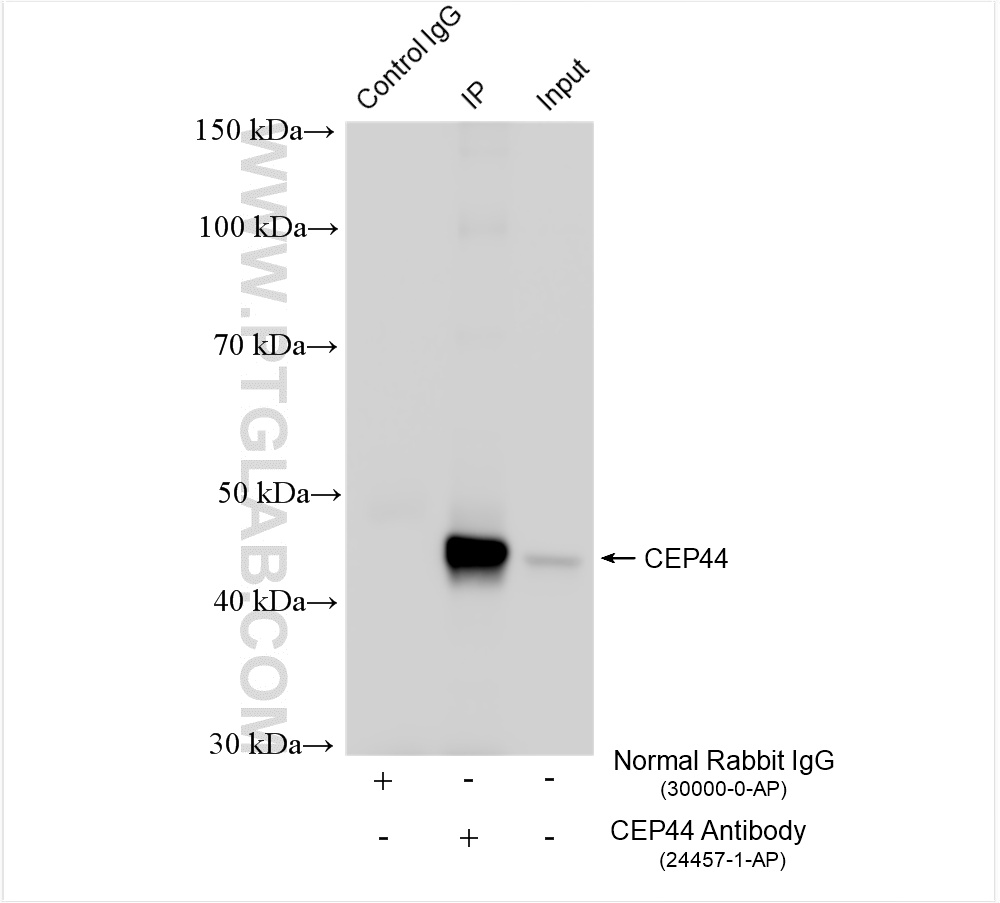 IP experiment of HeLa using 24457-1-AP