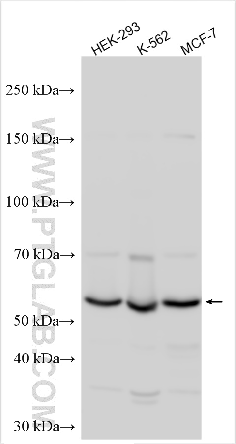 WB analysis using 30857-1-AP