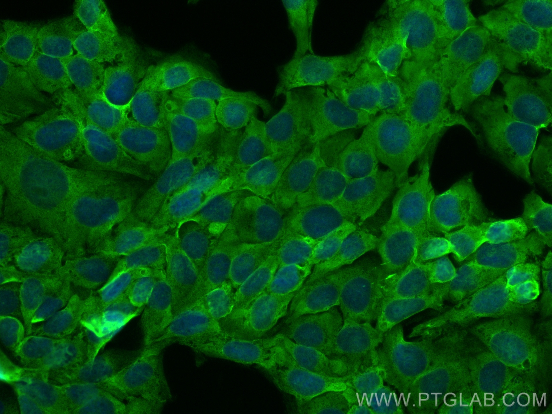 IF Staining of U2OS using 31308-1-AP