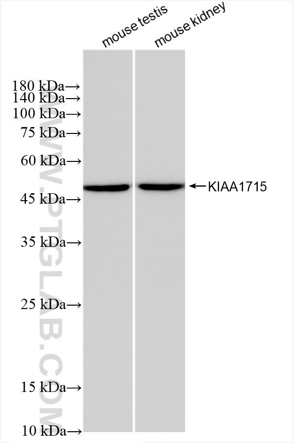 WB analysis using 83418-4-RR