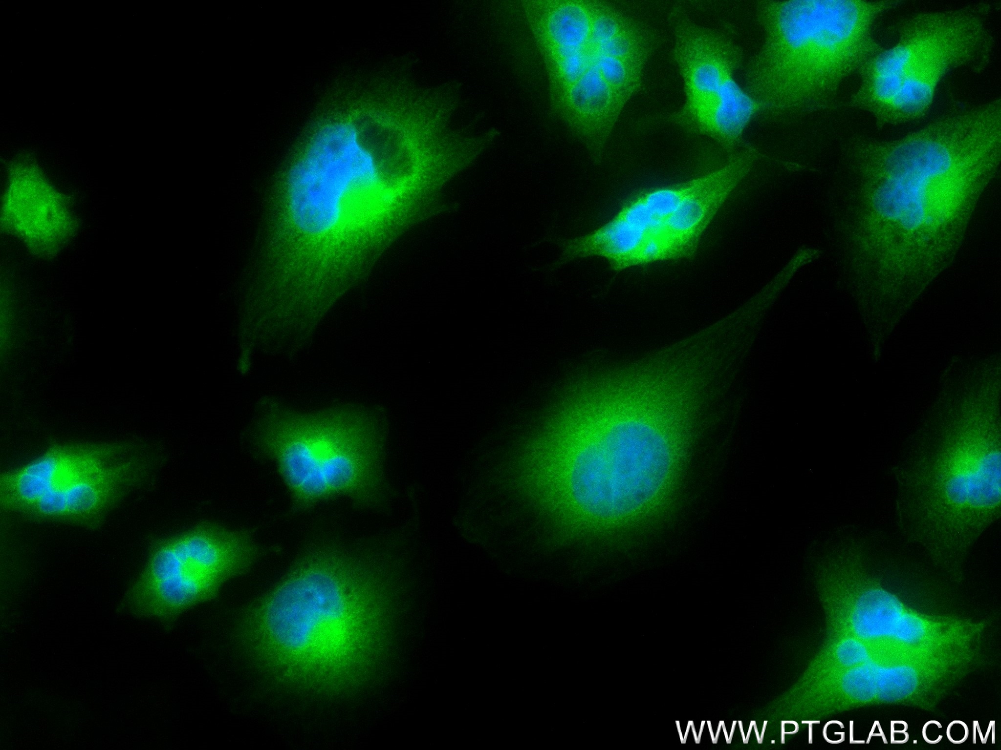 IF Staining of U-251 using 83418-5-RR (same clone as 83418-5-PBS)